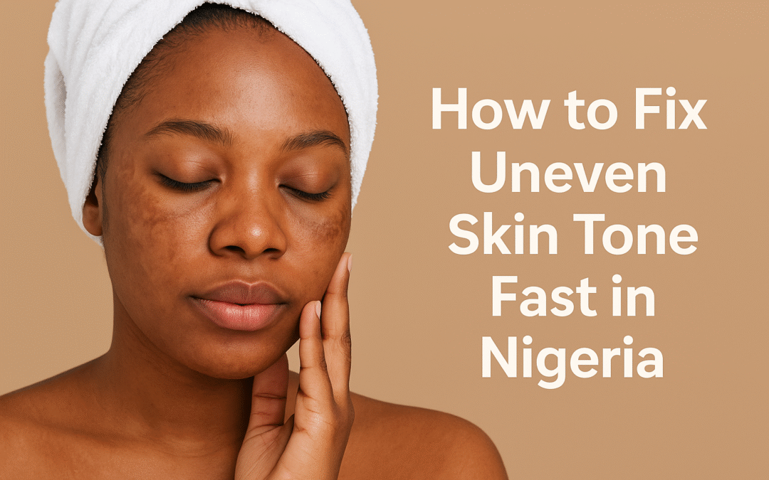 Nigerian woman with uneven skin tone and dark spots touching her face while wearing a white towel, used to illustrate a guide on how to fix uneven skin tone fast in Nigeria